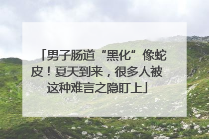 男子肠道“黑化”像蛇皮！夏天到来，很多人被这种难言之隐盯上