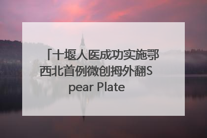 十堰人医成功实施鄂西北首例微创拇外翻Spear Plate髓内板矫形术